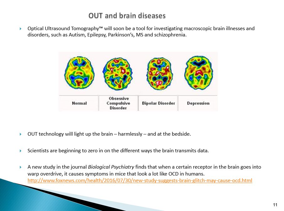 Explanation of brain diseases